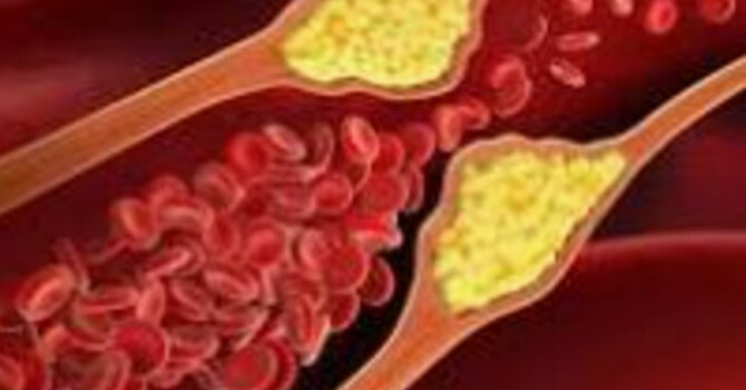 Why Your Cholesterol Goes Up After Menopause and What It Actually Means image
