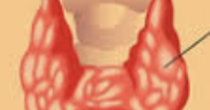 Part 1: Understanding Thyroid Function and Its Impact on Menopause image