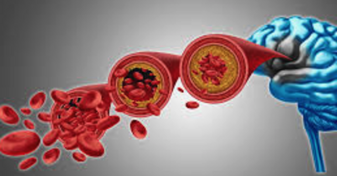 Does Hormone Therapy Protect or Harm Your Brain? What That Big 2023 Dementia Study Actually Means. image